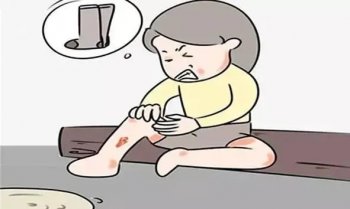 身上有皮肤癣会传染吗