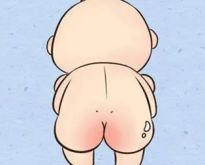 大腿内侧有股癣怎么办