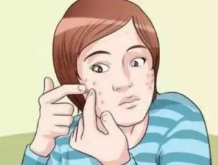 中学生青春痘怎么去除