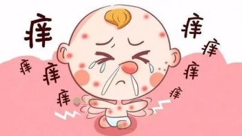 脚上湿疹怎么治才能祛除